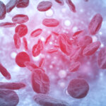 Malignant Hematology